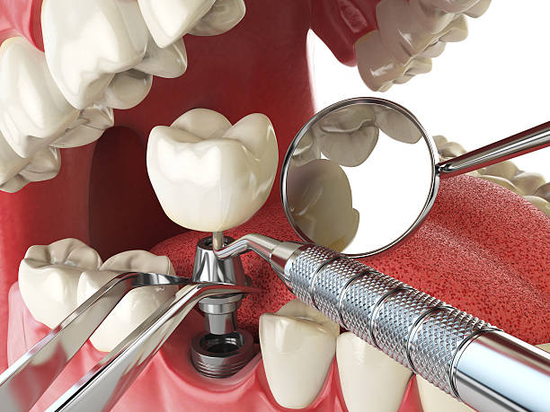 Best Urgent Dental Care for Toothaches in Biscoe, NC